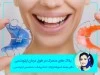 پلاک های متحرک در طول درمان ارتودنسی